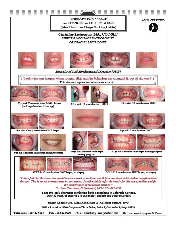 pictures of patient's teeth 