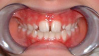 Orofacial Rest After Therapy photo 