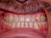Orofacial Rest After Therapy photo