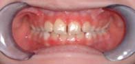 Orofacial Rest After Therapy photo