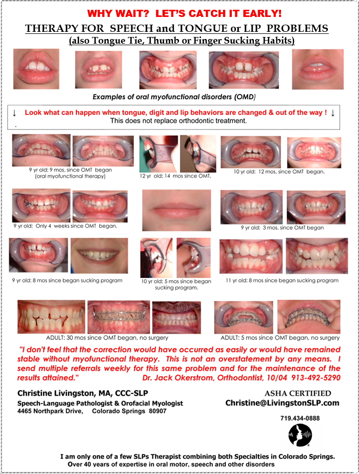 pictures of patient's teeth 