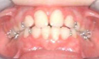 Orofacial Rest After Therapy photo