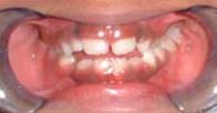 Orofacial Rest After Therapy photo